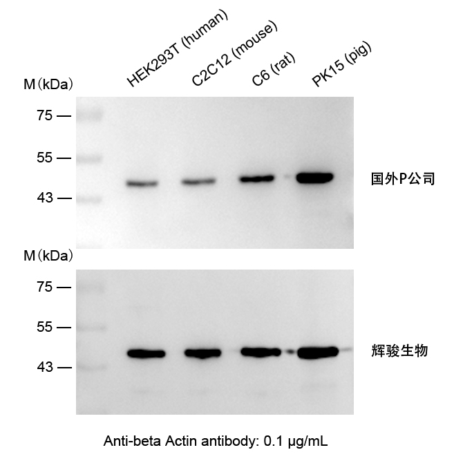 β-Actin小鼠單克隆抗體使用案例-抗體操作簡單,快速制備Actin抗體-輝駿生物 β-Actin小鼠單克隆抗體使用案例-抗體操作簡單,快速制備Actin抗體-輝駿生物